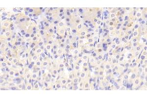 Detection of NT in Mouse Stomach Tissue using Polyclonal Antibody to Neurotensin (NT) (Neurotensin antibody  (AA 42-167))