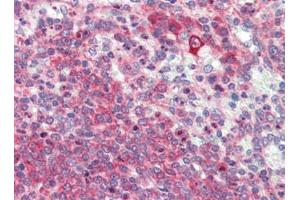 Human Spleen (formalin-fixed, paraffin-embedded) stained with LXNfollowed by biotinylated goat anti-rabbit IgG secondary antibody, alkaline phosphatase-streptavidin and chromogen. (Latexin antibody  (Center))