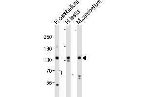 SKOR2 antibody  (C-Term)