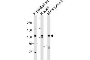 Western blot analysis of lysates from human cerebellum, human testis, mouse cerebellum tissue lysate (from left to right), using SKOR2 Antibody (C-term) (ABIN6244147 and ABIN6577773). (SKOR2 antibody  (C-Term))