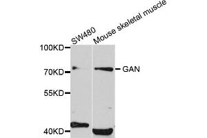 Western blot analysis of extracts of various cell lines, using GAN antibody (ABIN5972335) at 1/1000 dilution.
