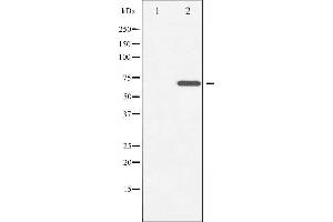 Western blot analysis of ZAP-70 phosphorylation expression in Jurkat whole cell lysates,The lane on the left is treated with the antigen-specific peptide. (ZAP70 antibody  (pTyr493))