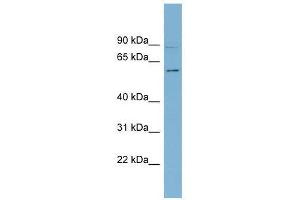 Western Blot showing HSF5 antibody used at a concentration of 1-2 ug/ml to detect its target protein. (HSF5 antibody  (Middle Region))