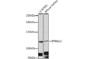 Western blot analysis of extracts of various cell lines, using EPB41L3 antibody (ABIN6127807, ABIN6140201, ABIN6140202 and ABIN6216501) at 1:3000 dilution. (EPB41L3 antibody  (AA 656-865))