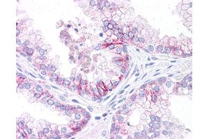 Immunohistochemistry (IHC) image for anti-CCAAT/enhancer Binding Protein (C/EBP), alpha (CEBPA) (Middle Region) antibody (ABIN504380) (CEBPA antibody  (Middle Region))