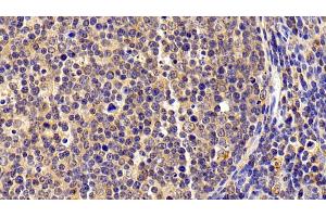 Detection of S100A8 in Porcine Lymph node Tissue using Polyclonal Antibody to S100 Calcium Binding Protein A8 (S100A8) (S100A8 antibody  (AA 1-89))