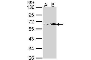 WB Image Sample (30 ug of whole cell lysate) A: H1299 B: Hela 10% SDS PAGE antibody diluted at 1:1000 (Fukutin antibody)