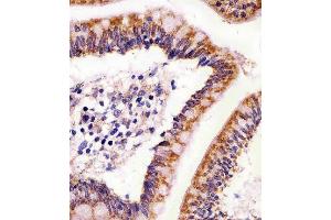 Paraformaldehyde-fixed, paraffin embedded human colon tissue, Antigen retrieval by boiling in sodium citrate buffer (pH6. (ABL2 antibody)