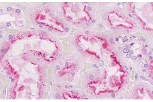 Human Kidney, Tubules: Formalin-Fixed, Paraffin-Embedded (FFPE) (GNAQ antibody  (AA 52-78))