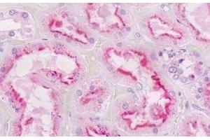 Human Kidney, Tubules: Formalin-Fixed, Paraffin-Embedded (FFPE)