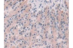 IHC-P analysis of Rat Stomach Tissue, with DAB staining. (Glucocorticoid Receptor antibody  (AA 564-733))
