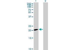 Claudin 20 antibody  (AA 1-219)