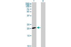 Western Blot analysis of CLDN20 expression in transfected 293T cell line by CLDN20 MaxPab polyclonal antibody. (Claudin 20 antibody  (AA 1-219))