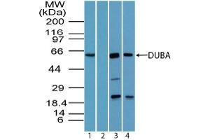 Image no. 2 for anti-OTU Domain Containing 5 (OTUD5) (AA 550-600) antibody (ABIN960300) (OTUD5 antibody  (AA 550-600))