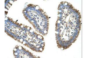 Image no. 1 for anti-DIS3-Like Exonuclease 2 (DIS3L2) (N-Term) antibody (ABIN202820) (DIS3L2 antibody  (N-Term))