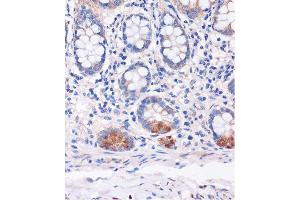 Immunohistochemistry of paraffin-embedded Human colon using SMYD3 Rabbit pAb (ABIN7270260) at dilution of 1:100 (40x lens). (SMYD3 antibody  (AA 50-150))