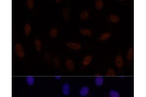Immunofluorescence analysis of U-2 OS cells using GLI2 Polyclonal Antibody at dilution of 1:100. (GLI2 antibody)