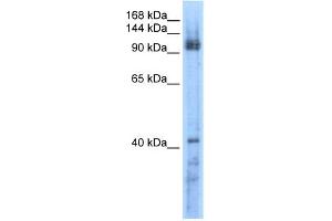 WB Suggested Anti-RECQL5 Antibody Titration:  0. (RECQL5 antibody  (Middle Region))