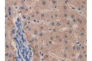 Detection of F8 in Human Liver Tissue using Polyclonal Antibody to Coagulation Factor VIII (F8) (Factor VIII antibody  (AA 2253-2346))