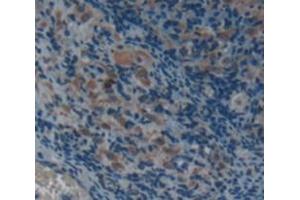 Immunohistochemistry (IHC) image for anti-alpha-2-Macroglobulin (A2M) (AA 818-1048) antibody (ABIN1857845)