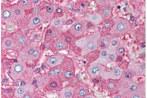 Human Liver (formalin-fixed, paraffin-embedded) stained with Albumin antibody ABIN291153 at 5 ug/ml followed by biotinylated anti-mouse IgG secondary antibody ABIN481714, alkaline phosphatase-streptavidin and chromogen. (Albumin antibody)