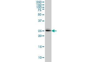 GRCC9 monoclonal antibody (M01), clone 1E6 Western Blot analysis of SPSB2 expression in A-549 . (SPSB2 antibody  (AA 1-90))