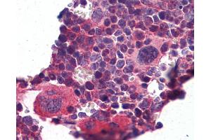Anti-KLF2 antibody IHC of mouse lymphoid tissue. (KLF2 antibody  (N-Term))