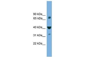 WB Suggested Anti-VPS16 Antibody Titration: 0. (VPS16 antibody  (Middle Region))