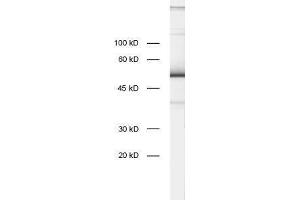 dilution: 1 : 1000, sample: rat brain homogenate (ZnF 370 antibody)
