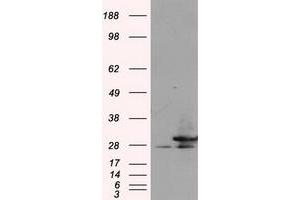 Image no. 3 for anti-Replication Protein A2, 32kDa (RPA2) antibody (ABIN1500739) (RPA2 antibody)