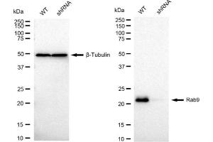 Western blotting analysis using Rab9 antibody (ABIN7800109). (Recombinant RAB9A antibody)
