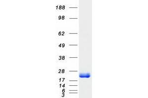Western Blotting (WB) image for ADP-Ribosylation Factor 3 (ARF3) protein (Myc-DYKDDDDK Tag) (ABIN2714427)