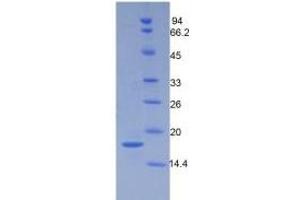 SDS-PAGE (SDS) image for Periostin (POSTN) ELISA Kit (ABIN6574326)
