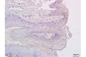 Formalin-fixed and paraffin embedded rat exfoliated cells labeled with Anti-CXCR3 Polyclonal Antibody, Unconjugated (ABIN678653) at 1:200 followed by conjugation to the secondary antibody and DAB staining (CXCR3 antibody  (AA 301-367))