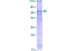 Adiponectin Receptor 1 Protein (ADIPOR1) (AA 1-375) (GST tag)