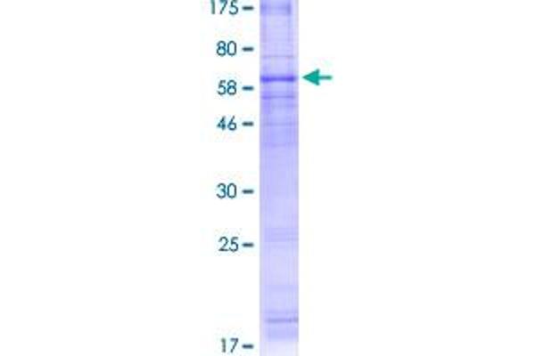 Adiponectin Receptor 1 Protein (ADIPOR1) (AA 1-375) (GST tag)