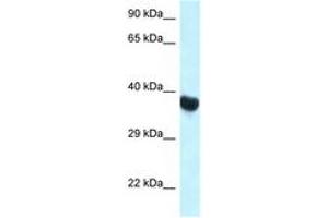 Image no. 1 for anti-Homeobox A10 (HOXA10) (C-Term) antibody (ABIN6747342) (HOXA10 antibody  (C-Term))