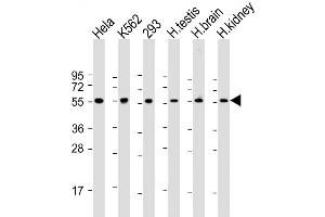 Western Blot at 1:2000 dilution Lane 1: Hela whole cell lysate Lane 2: K562 whole cell lysate Lane 3: 293 whole cell lysate Lane 4: human testis lysate Lane 5: human brain lysate Lane 6: human kidney lysate Lysates/proteins at 20 ug per lane.