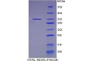 SDS-PAGE analysis of Human IRF6 Protein.