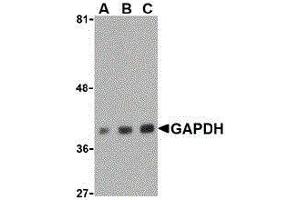 Western Blotting (WB) image for anti-Glyceraldehyde-3-Phosphate Dehydrogenase (GAPDH) (C-Term) antibody (ABIN2473758) (GAPDH antibody  (C-Term))