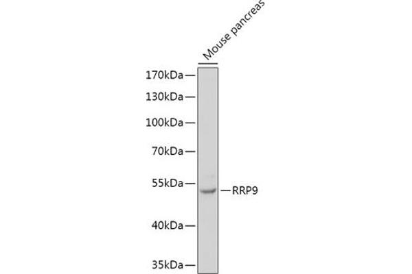 RRP9 抗体  (AA 156-475)