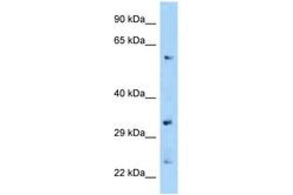 ZNF664 antibody  (C-Term)