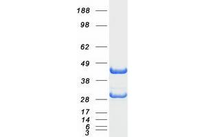 EEF1B2 Protein (Transcript Variant 1) (Myc-DYKDDDDK Tag)