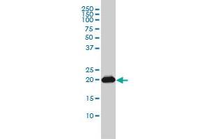 RAP2B monoclonal antibody (M01), clone 4F12-3C6 Western Blot analysis of RAP2B expression in A-431 . (RAP2B antibody  (AA 1-183))