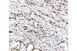 IHC analysis of RRS1 using anti-RRS1 antibody (ABIN7601344). (RRS1 antibody  (AA 33-266))
