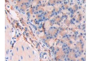 Immunohistochemistry (IHC) image for anti-CD34 (CD34) (AA 36-287) antibody (ABIN7434413)