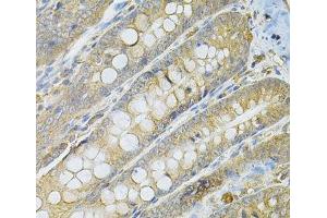 Immunohistochemistry of paraffin-embedded Rat intestine using SERPINA6 Polyclonal Antibody at dilution of 1:100 (40x lens). (SERPINA6 antibody)