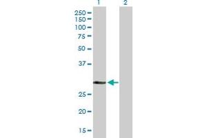 Western Blot analysis of DHRS9 expression in transfected 293T cell line by DHRS9 MaxPab polyclonal antibody. (DHRS9 antibody  (AA 1-319))