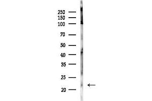 Western blot analysis of lysates from Hela cells(heat-shock,45 min treatment), using IF Antibody at 1/1000 dilution.