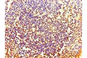 Immunohistochemistry of paraffin-embedded human tonsil tissue using ABIN7155713 at dilution of 1:100 (HOXA2 antibody  (AA 26-124))